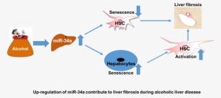 “understanding The Mechanisms Underlying Hsc Activation - Senescence Liver #8309231