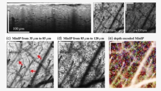 Xf Visocm In Vivo Imaging Of Neural Cells - Tree #8318217