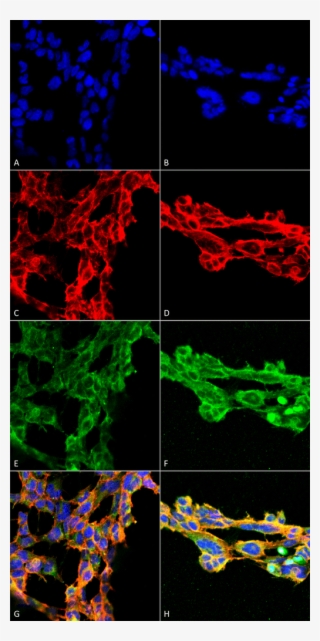 Smc 512 7 Ketocholesterol Antibody 7e1 Icc If Human - Art #8375397