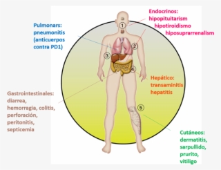 Los Efectos Secundarios Más Frecuentes - Cartoon #8401001 Los Efectos Secundarios Más Frecuentes - Cartoon #8401001