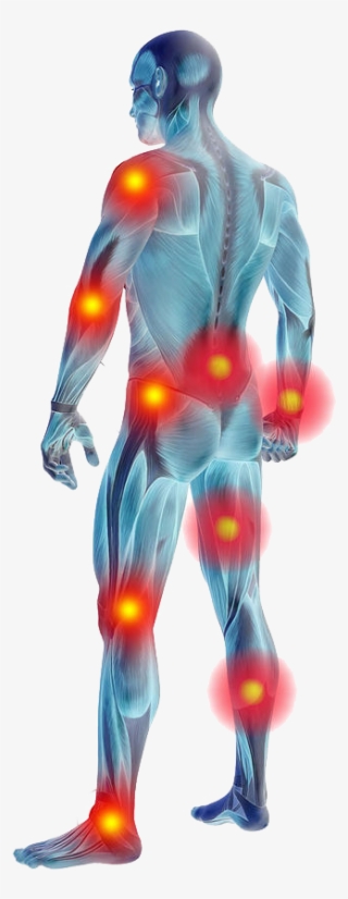 Muscle Pain Remedies - Muscle Pain Png #8424846