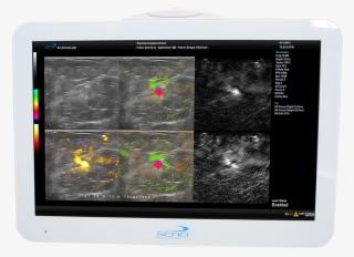 Monitor-950w - Seno Medical #8454341