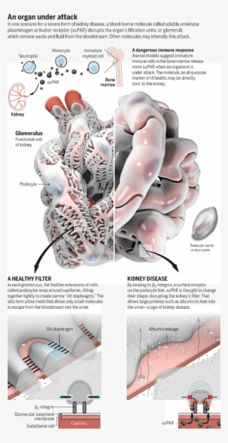 Supar And Kidney Disease - Diagram #8473305