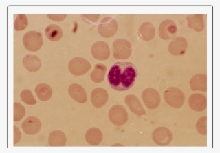 Lymphocyte With A Dumbbell Shaped Nucleus - Circle #8517801