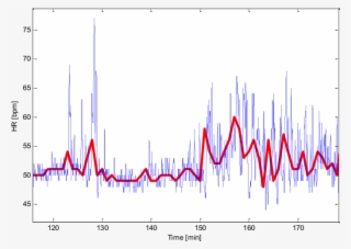 Heart Rate From The Ppg Sensor Of Somnoscreen And Basis - Diagram #8574659