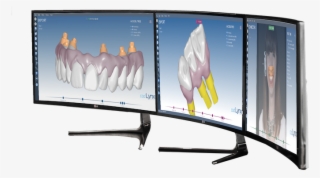 Cad-lynx - 3d Dental Cad #8583388