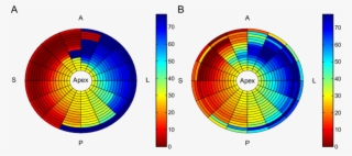 Bull's-eye Plots Of Depolarization Times From A Patient - Semantic Web #8583684