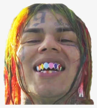 Lien Direct, 2018/16/3/1524070438 6ix9ine Face Kekeh - Xxxtentation Dents #8637521