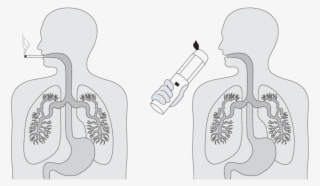 Rationale For Pulmonary Delivery To Manage The Premetastatic - Illustration #8643977
