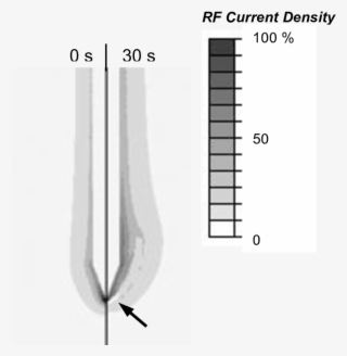 Electrical Rf Current Density For Cooled Needle Electrode - Sketch #8708621