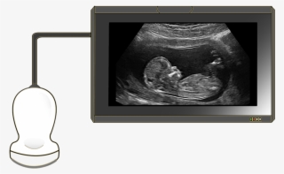 Ultrasound - Cuarto Mes De Embarazo Ecografia #8712649