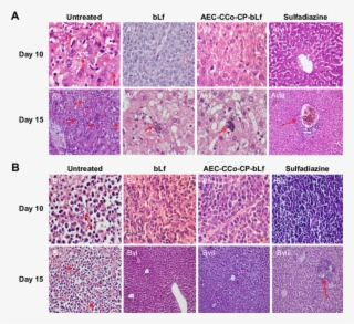 Histpathological Analysis In Liver And Spleen At Day - Art #8741947