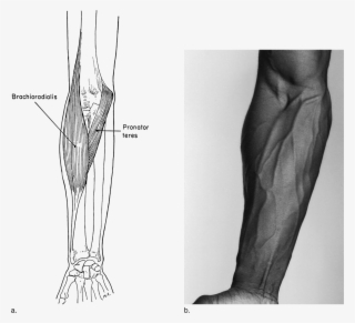 Image Not Available - Sketch #8756417