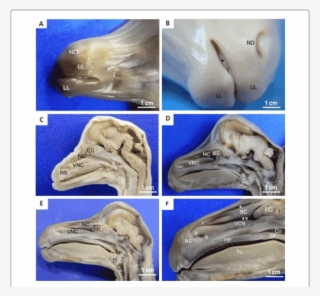 Observe Nostrils With The Nasal Diverticulum Closed, - Nasal Diverticulum #8764158 Observe Nostrils With The Nasal Diverticulum Closed, - Nasal Diverticulum #8764158