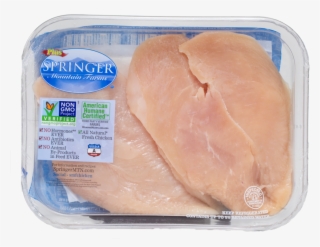Breast #8764366