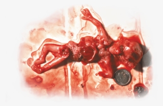 Free Png Download Not Your Body Abortion Meme Png Images - Marie Stopes Abortion Kenya #8818709