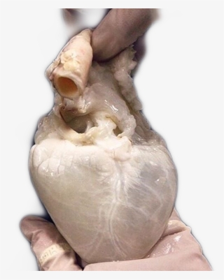 Heart Sticker - Human Heart Drained Of Blood #8898093