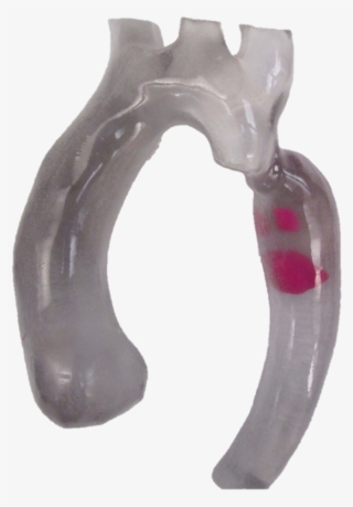 3d Printed Aortic Arch With Thrombus - Diagonal Pliers #8907619
