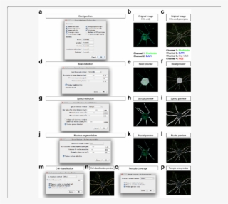 Configuration Of The Sprout Analyzer Plugin - Component Testing Using Cro #8928192