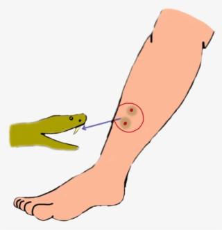 Treatment - #8939307