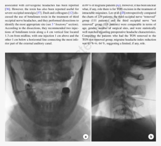 21 Open-mouth Radiofrequency Lesioning - Radiology #8969328