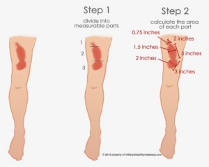 Scar Example 3 - Military Scars #98121