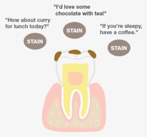 Stain 'i'd Love Some - Sunstar #908364