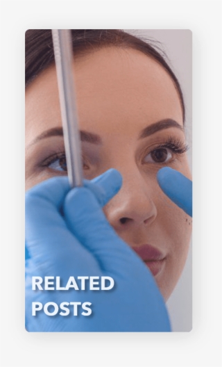 Nose Surgery Related Posts - Rhinoplasty #9009616