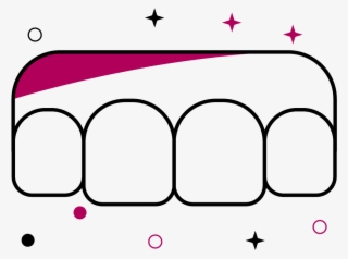 Aesthetic Gum Surgery - Diagram #9009631