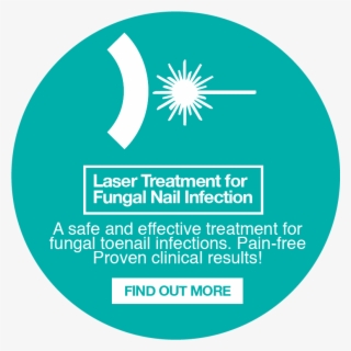 Laser-slider #9061607