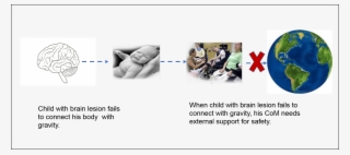 Child With Brain Lesion Can Not Connect To Gravity - Sphere #9063521