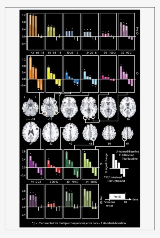 Percent Signal Change For Each Roi, Showing That Training - Broca Wernicke #9068977