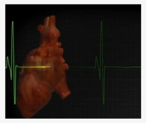 A “band-aid” To Heal Hearts - Plant #916771