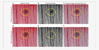 Top Row Shows How Tracheid Lumina Obscured By A Dust - Circle #9111121