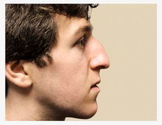 0004 Josh Katz Before Edit - Human #9153898