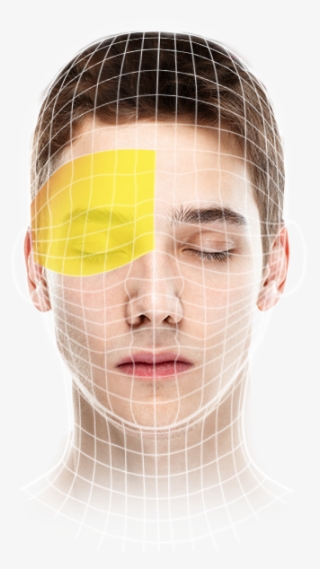 Cluster Headache - Human #9189279