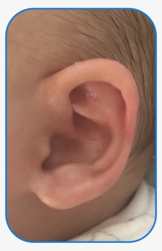 Ear Buddies Parent Review - Flesh #9202158
