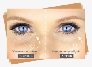 Eyes - Apply Concealer Under Eye #9245779