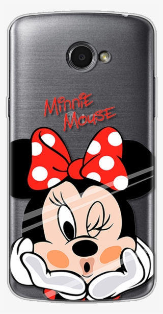 Θηκεσ Κινητων Xiaomi Redmi 5 #9260727