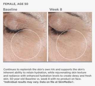 Results After 8 Weeks - 30 Year Old Skin Close Up #9278534