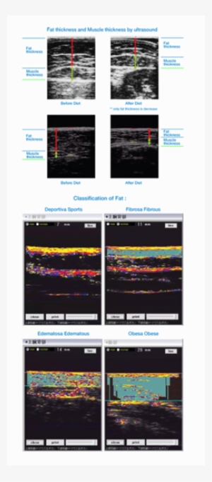 Download Weight Loss Clipart Green Coffee Extract Weight - Saptrees #937140