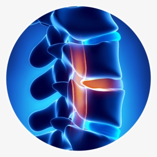 Spinal Stenosis Scar Tissue Or Surgical Error From - Bel Fıtığı #9303207