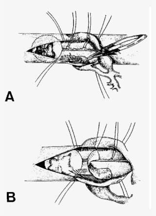 The Spinal Cord Is Cross Sectioned To Show The Depth - Insect #9303231
