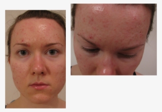 Picture23 - Scar #9313706