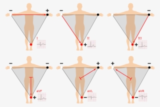 Einthoven's Triangle #9350239 Einthoven's Triangle #9350239