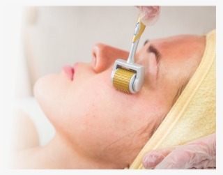 Tu Nuevo Aliado Contra Las Manchas La Aplicación De - Tratamiento Facial Con Dermaroller #9372918