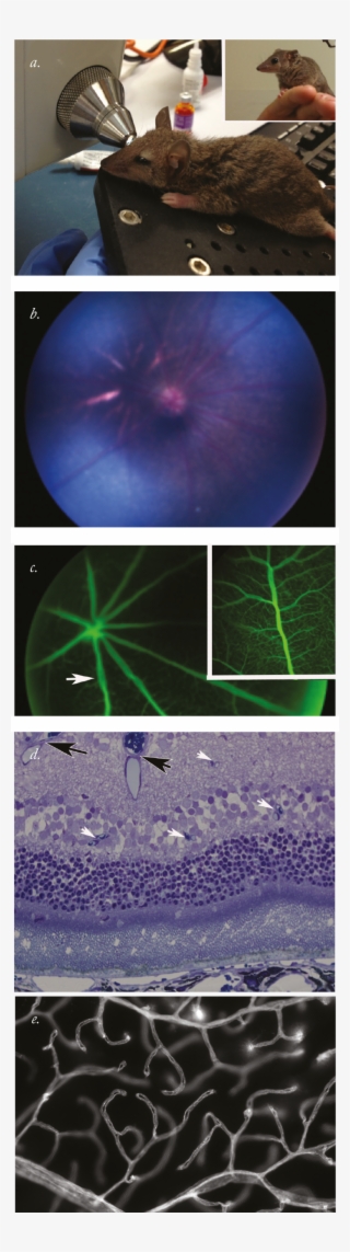A Lesson From The Eye Of Marsupials - Laser #9375101