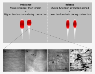 An Increase In The Stiffness Of The Tendon Results - Diagram #9383970