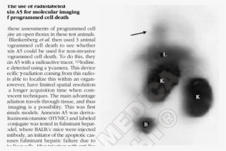 Arrowhead Points Out Uptake Of Technetium Labeled Annexin - Number #9469707