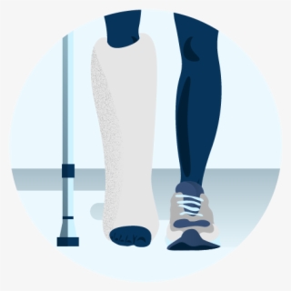 Illustration Of A Person's Leg In A Cast - Illustration #9472984